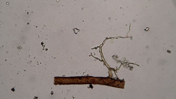 Biological background with a twig in center and a lot of bacteria and microorganisms — Stock Video