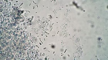 Mikroskop altında incelenmek üzere bakterili bir ilacın kamerasını çevirmek.