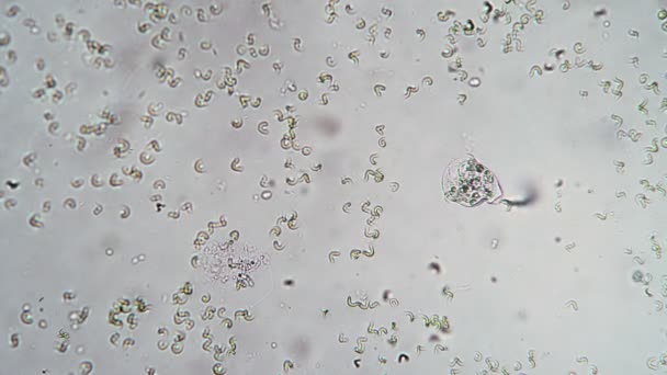 纤毛食管菌浮游、停留及以细菌为食 — 图库视频影像