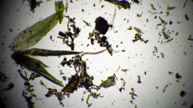 Mikroskop altında bir damla su, nematode solucanı ve infusoria.