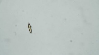 Siyanobakteri diatomea alg cymbella mikroskopta beyaz bir arkaplanda izole edilmiştir.