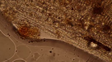 Kapana kısılmış siliyatlar dışarı çıkamaz, mikroskobik arkaplan....