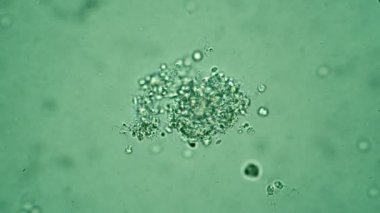 Protozoa mikroorganizmaları ve bakterilerin yaşadığı yeşil algler.