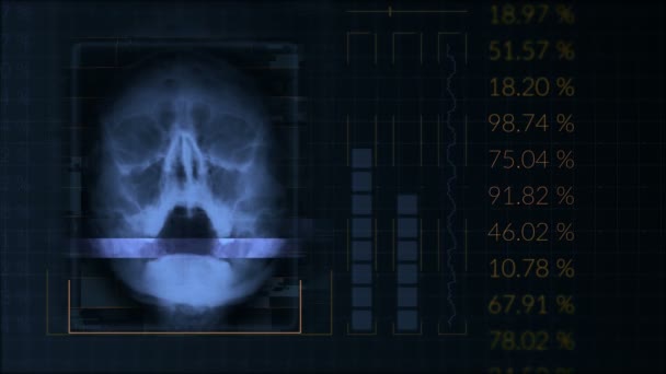 Skanowanie ludzkiej czaszki, zapętlony interfejs Blue Hud sprzęt medyczny — Wideo stockowe