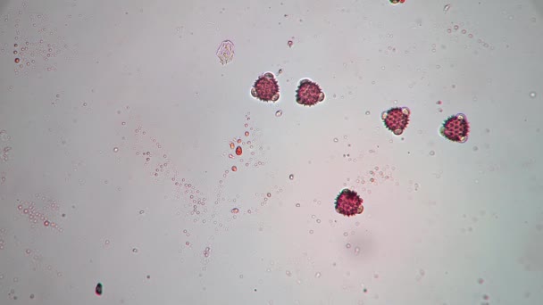 Kerek tüskés sejtek, amelyek úgy néznek ki, mint egy coronavirus covid-19 vírus nagyítása mikroszkóppal — Stock videók