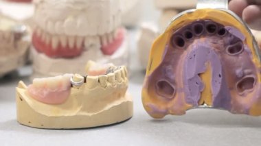 Doktor çene düzeni için şablonu gösterir ve diş başlığını kaldırır
