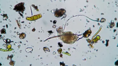 Büyük bir kemirgen solucanı mikroskop altında bir damla suda algler ve çamur arasında beslenir.
