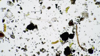 Büyük bir nematode kurdu kirli sularda hareket eder. Mikroskop altında yakınlaşır.