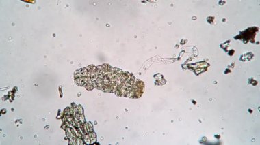 Kahverengi tardigrad mikroskop altında suda yüzüyor.