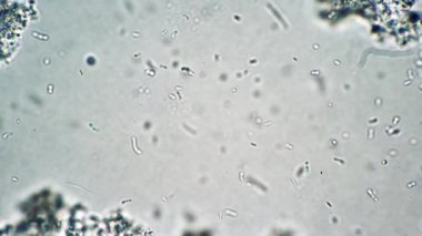 Laktik asit bakterileri mikroskop altında süt ürünlerinde yavaş yavaş akıyor.