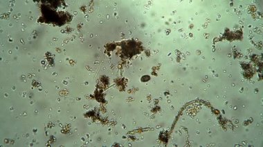 Küçük oval infusoria Tayland bataklık suyunda hareket ediyor ve kendi etrafında dönüyor.