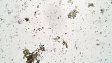 Bakteri ve ciliate Colpoda, Tayland bataklığından mikroskop altında su içinde yol alıyor.