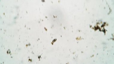 Kahverengi oval infusoria Coleps mikroskop altında sarı yuvarlak olanı yemeye çalışıyor.