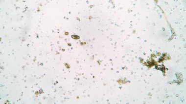 Küçük oval infusoria Coleps mikroskop altında Tayland bataklığından gelen suda yüzüyor.