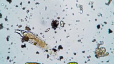 Kroket ustası suda sürünüyor, mikroskop altında hareket etmeye çalışıyor.