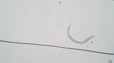 Nematode suyun kenarında kıpırdıyor ve büyüterek uzaklaşıyor.