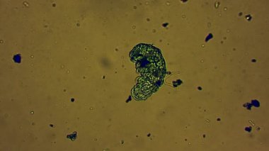 Yeşil tardigrad patilerini suda hareket ettirir. Mikroskop altında yakınlaşır.