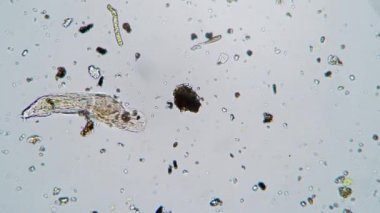 Küçük roketleyici diğer hayvanlarla birlikte mikroskop altında hareket ediyor.