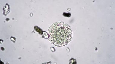 Mikroskop altında çok hücreli protozoalı bir hayvan.