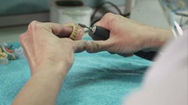 Diş teknisyeni yapım deture prothese