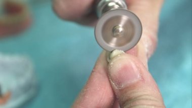 Diş protez Laboratuvarı teknisyeni kesmek