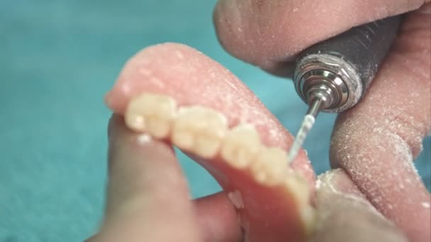 Dentist makes a dental implant prosthesis made of plaster cast — Stock Video