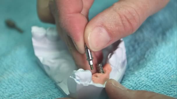Zubař je znázorněn Model zubní protézu s implantátem — Stock video