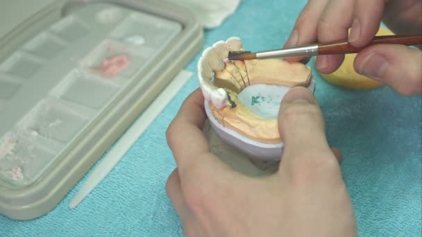 Tandtechnicus maken tanden implantaat — Stockvideo
