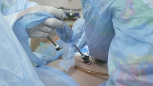 Operasi menggunakan peralatan endoskopi — Stok Video