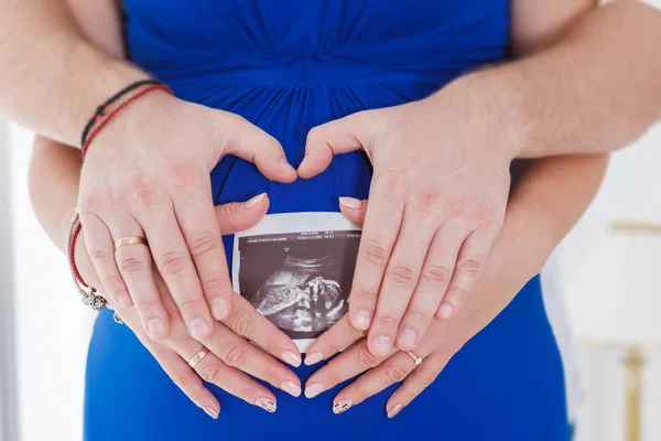 Embarazada esperando un niño sosteniendo ultrasonido —  Fotos de Stock