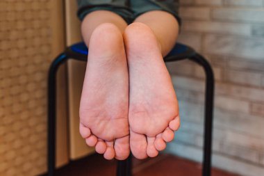 Bir çocuğun topukları. Çocuk sandalyede diz çöküyor.