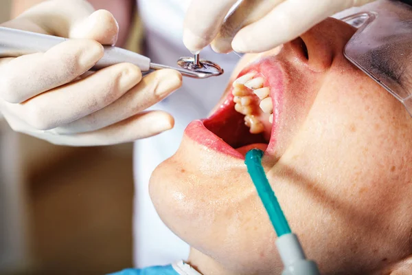 Odontología, examen del paciente y tratamiento en el dentista —  Fotos de Stock