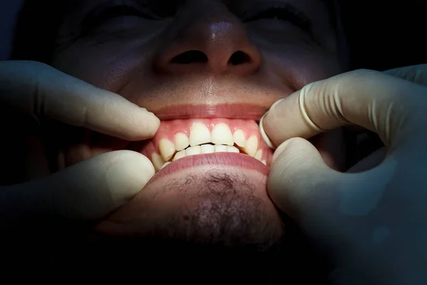 Odontología, examen del paciente y tratamiento en el dentista —  Fotos de Stock