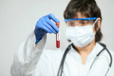 Doktor bilim adamı 2019 nCoV analizi için test tüpünü kanla tutuyor. Çin Koronavirüsü kan testi konsepti. Aşı araştırması.