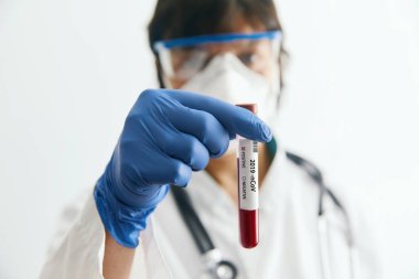 Koruyucu eldivenler, maske ve gözlük takan doktor 2019 nCoV analizi için kan tüpü tutuyor. Kan örneği. Corona virüsü salgını. Salgın Virüsü Solunum Sendromu.