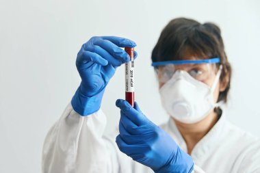 Coronavirus 2019 nCoV kan örneği. Yeni Salgın Corona Virüsü. Corona virüsü salgını. Laboratuvardaki Corona Virüsü. Koruyucu eldivenler, maske ve gözlük takan bilim adamı.