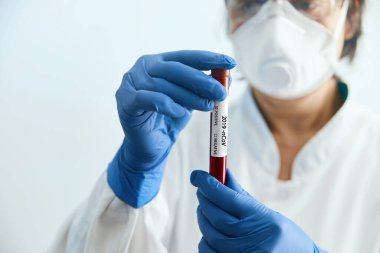 Koruyucu eldivenler, maske ve gözlük takan doktor 2019 nCoV analizi için kan tüpü tutuyor. Kan örneği. Corona virüsü salgını. Salgın Virüsü Solunum Sendromu.