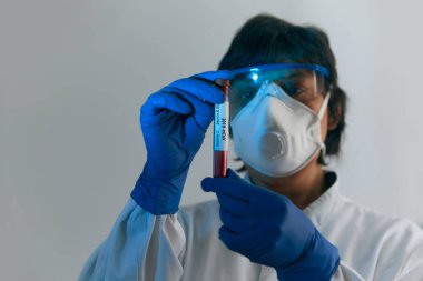 Coronavirus 2019 nCoV kan örneği. Koruyucu eldivenli, maskeli ve gözlüklü bir doktor 2019 nCoV analizi için üzerinde kan olan test tüpü tutuyor. Coronavirus kan testi konsepti. Aşı araştırması