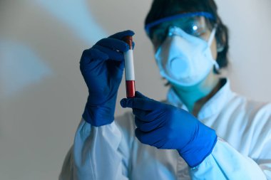 Coronavirus 2019 nCoV kan örneği. Yeni Salgın Corona Virüsü. Corona virüsü salgını. Laboratuvardaki Corona Virüsü. Koruyucu eldivenler, maske ve gözlük takan bilim adamı.