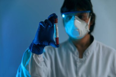 Koruyucu eldivenler, maske ve gözlük takan doktor 2019 nCoV analizi için kan tüpü tutuyor. Kan örneği. Corona virüsü salgını. Salgın Virüsü Solunum Sendromu. 