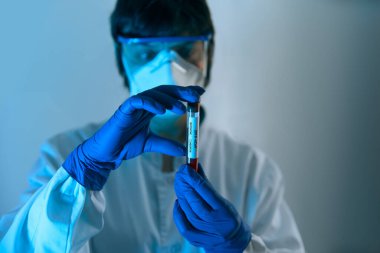 Coronavirus 2019 nCoV kan örneği. Koruyucu eldivenli, maskeli ve gözlüklü bir doktor 2019 nCoV analizi için üzerinde kan olan test tüpü tutuyor. Coronavirus kan testi konsepti. Aşı araştırması