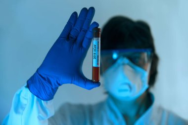 Coronavirus 2019 nCoV kan örneği. Yeni Salgın Corona Virüsü. Corona virüsü salgını. Laboratuvardaki Corona Virüsü. Koruyucu eldivenler, maske ve gözlük takan bilim adamı.