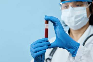 Koruyucu eldivenler, maske ve gözlük takan doktor 2019 nCoV analizi için kan tüpü tutuyor. Kan örneği. Corona virüsü salgını. Salgın Virüsü Solunum Sendromu. 