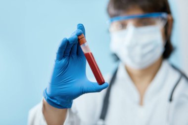 Coronavirus 2019 nCoV kan örneği. Yeni Salgın Corona Virüsü. Corona virüsü salgını. Laboratuvardaki Corona Virüsü. Koruyucu eldivenler, maske ve gözlük takan bilim adamı.