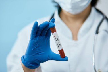 Coronavirus 2019 nCoV kan örneği. Koruyucu eldivenli, maskeli ve gözlüklü bir doktor 2019 nCoV analizi için üzerinde kan olan test tüpü tutuyor. Coronavirus kan testi konsepti. Aşı araştırması
