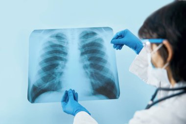 Doktor bilim adamı göğüs röntgeni filmindeki viral enfeksiyonu ya da zatürree lezyonunu inceliyor. Coronavirus 2019, COVID-19