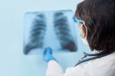Hastanedeki klinikte bulunan Covid-19 hastasının viral zatürresi için akciğerlerinin röntgenlerini inceleyen bir tıp doktoru. Coronavirus konsepti 