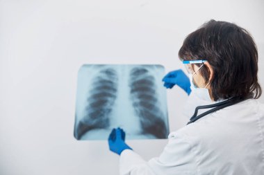 Dotor Scientist göğüs röntgeni filmindeki viral enfeksiyonu ya da zatürree lezyonunu inceliyor. Coronavirus 2019, COVID-19