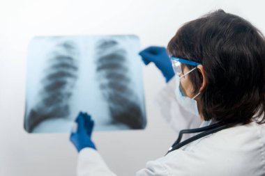 Doktor bilim adamı göğüs röntgeni filmindeki viral enfeksiyonu ya da zatürree lezyonunu inceliyor. Coronavirus 2019, COVID-19