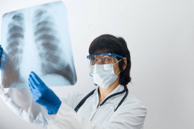 Doktor bilim adamı göğüs röntgeni filmindeki viral enfeksiyonu ya da zatürree lezyonunu inceliyor. Coronavirus 2019, COVID-19